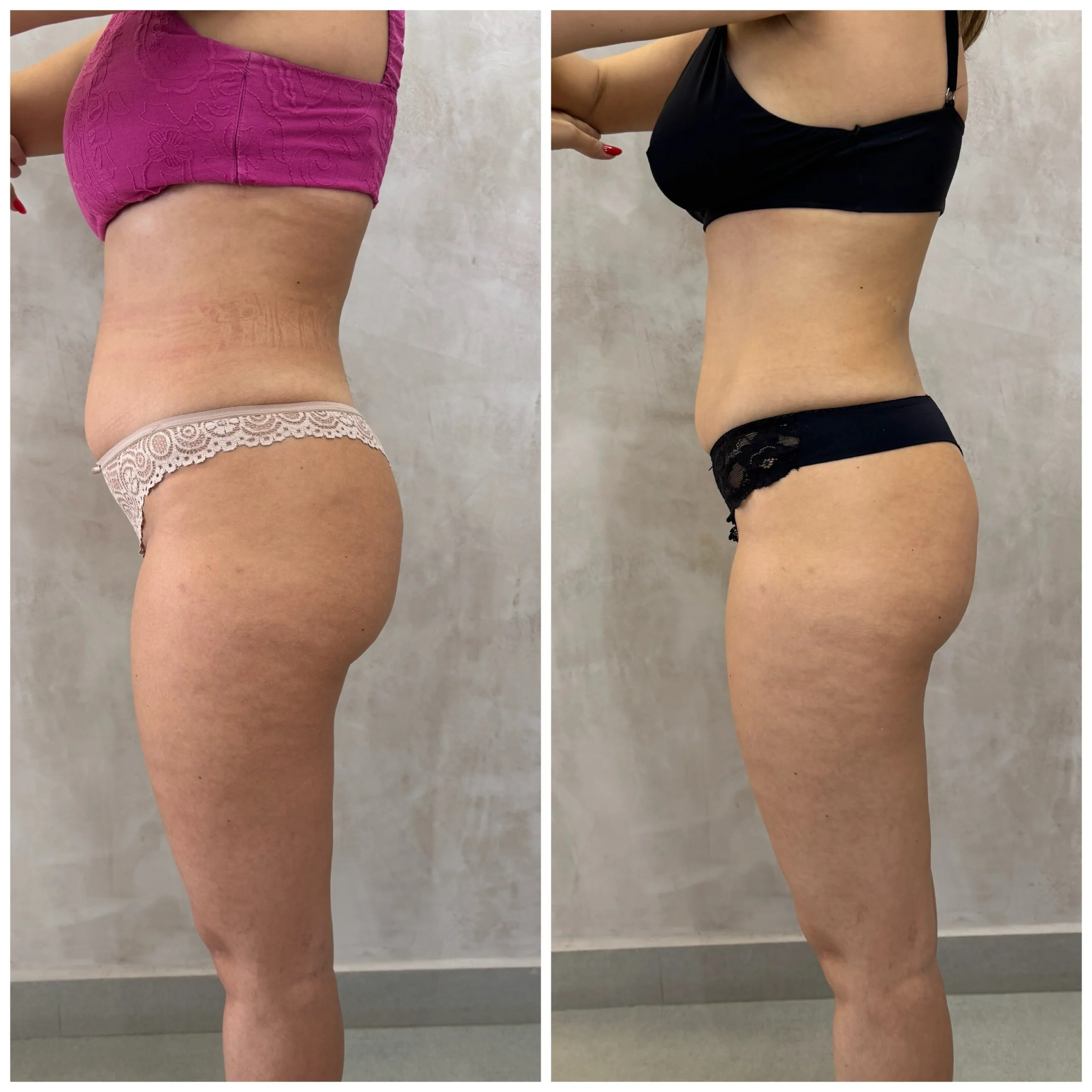 3421074_1_1763985009692446711124d6449014488552665