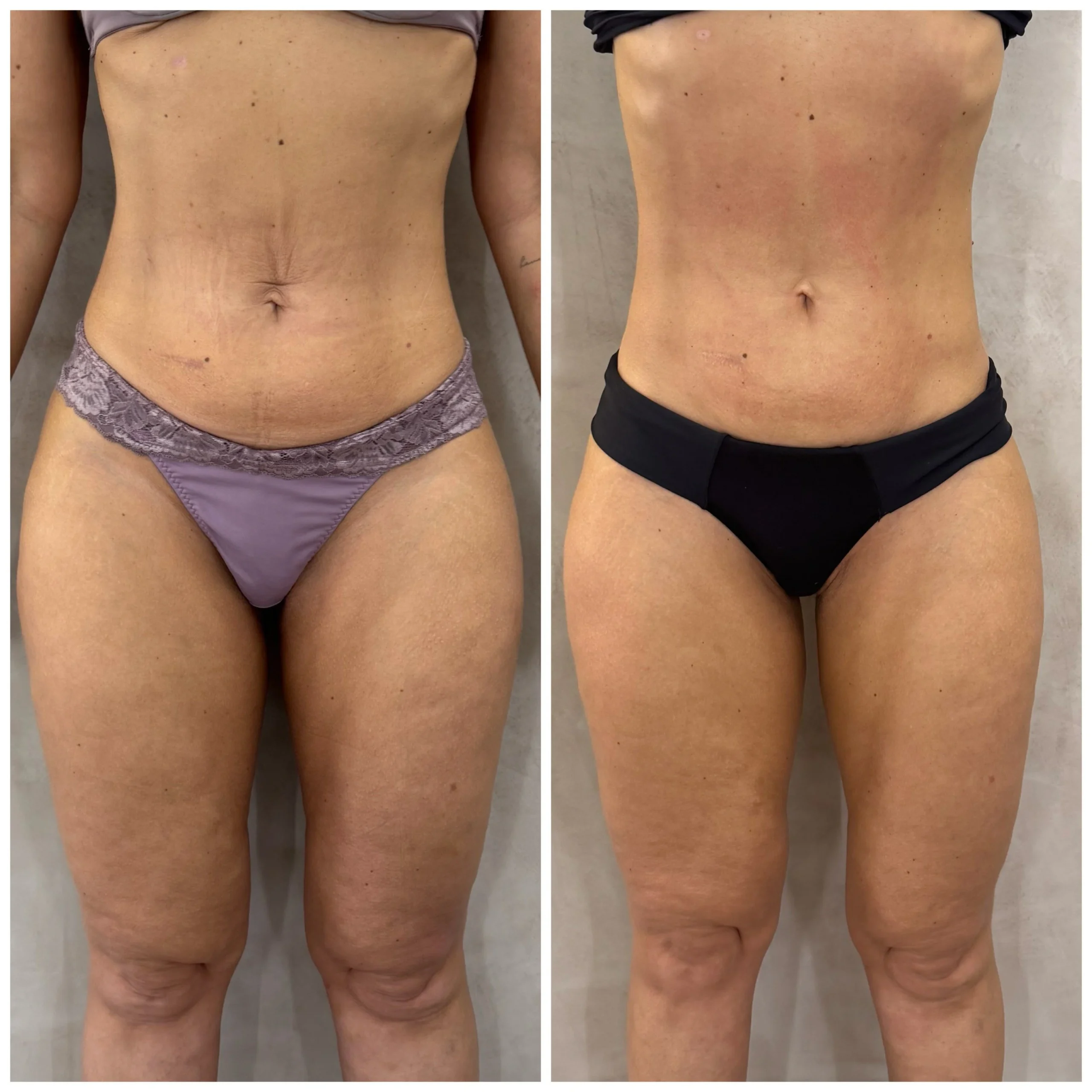 3421074_1_1763985009692446711124d6449014489876770