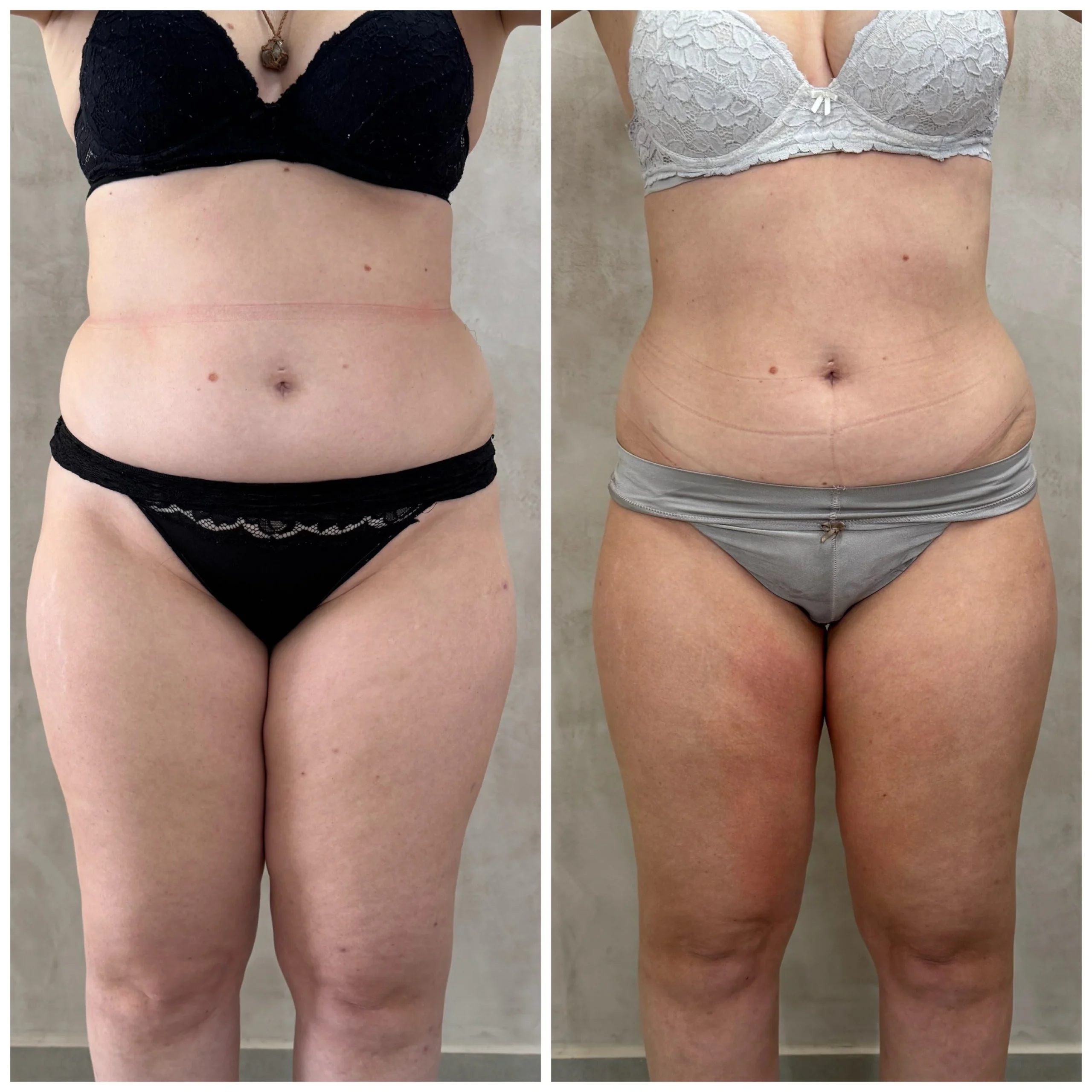 3421074_1_1763985009692446711147e7012980003033365